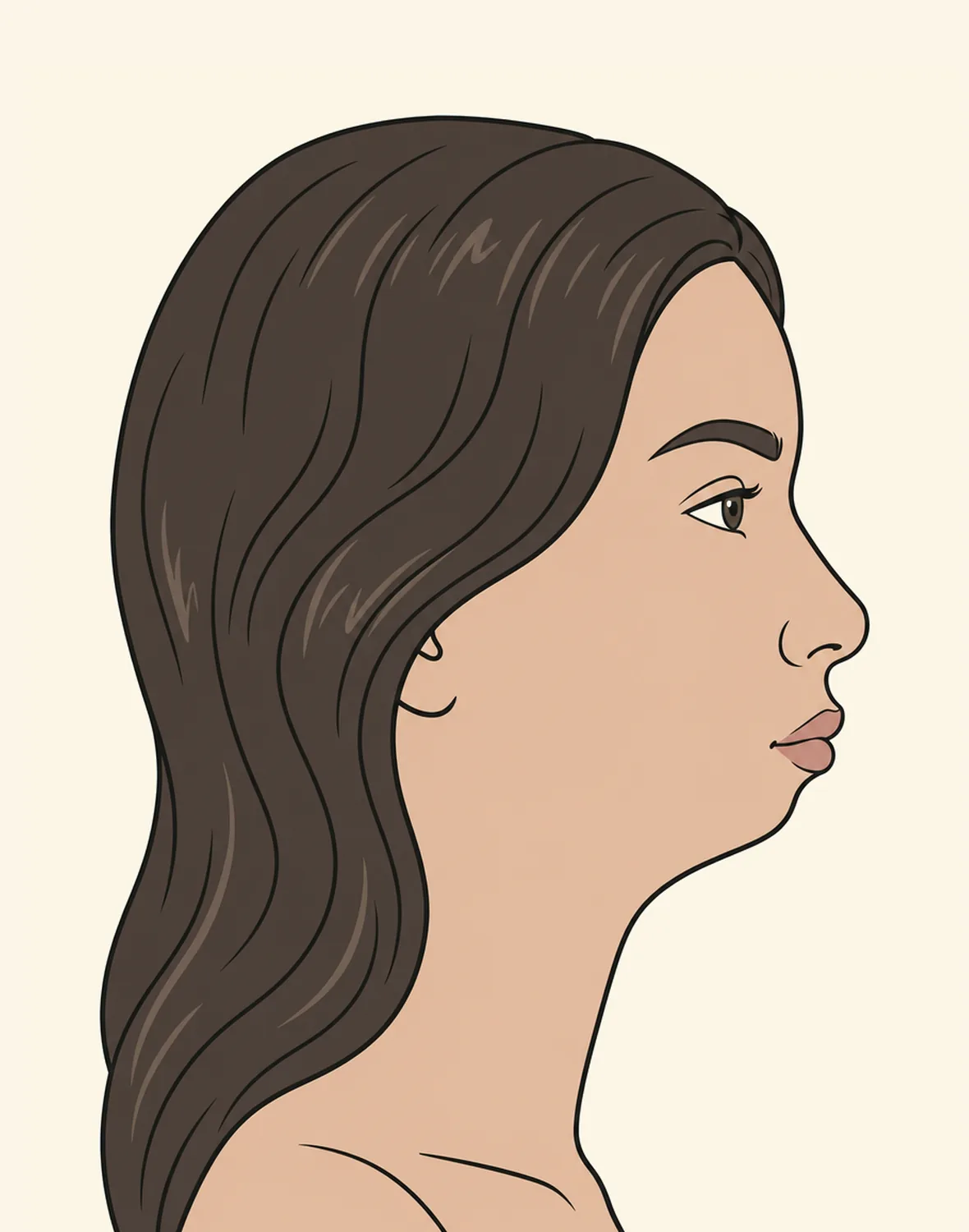 Dasselbe Profil: der Hals ist schlank und ohne Fett, aber das Kinn liegt weit hinter der Lippenlinie, eine Kieferkante gibt es nicht, der Übergang zum Hals verläuft als weicher Bogen.